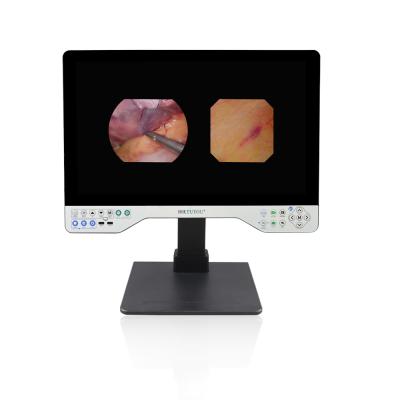 China 1080P Full HD Endoscopesysteem Stijve en flexibele 24 inch All in One Video Recorder Camera Te koop