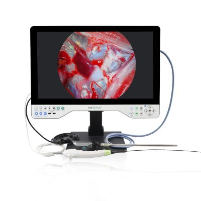 China TUYOU Medical 1080P 24' Stijf en flexibel alles in één endoscoopcamera perfect voor uroscopie chirurgie waterdicht Te koop