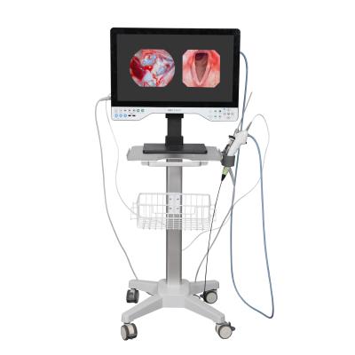 China FHD All In One Endoscope Camera System Built-in LED Light & Flexible Scope For Laparoscopy for sale