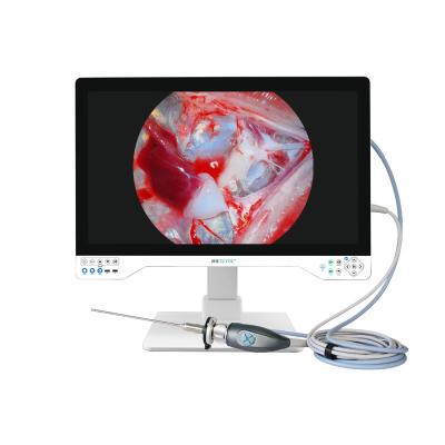 China 32' All In One TUYOU 4K Rigid Endoscopy Camera Lichtbron Endoscoop Registratie Systeem Voor Cyste Fenestratie Lever Te koop