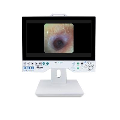 China All in One Rigid and Flexible Endoscopy Camera TU-15LSD1E HDMI/SDI/CVBS/VGA/DVI Output Interface and Built-in Light Source for sale