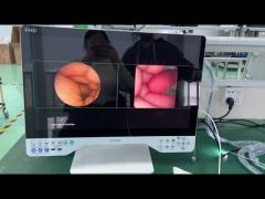 24inch rigid and flexible all in one endoscope camera system