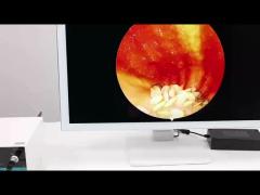 TU-PY460T+TU-GY460T HD Endoscope Camera and Light Source for ENT and Laparoscopic Surgery