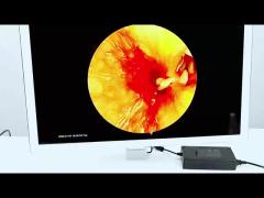 TUYOU HD Endoscope Camera with Multi-Language Support for ENT and Laparoscopic Procedures