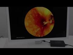 TUYOU High-Definition Endoscope Camera System for Nasal, Ear, and Laparoscopic Procedures