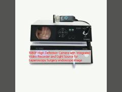 1080P High Definition Camera with Integrated Video Recorder and Light Source for Laparoscopy Surgery endoscope image