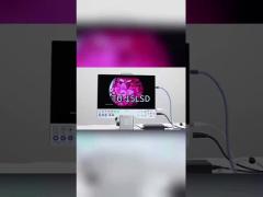 TUYOU Full HD 1080P 15.6 Inch All In One Medical Endoscopy Camera System For ENT Sinus Urology