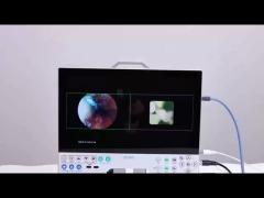 TUYOU  15.6 Full HD 1080P Inch All In One Medical Endoscopy Camera System For ENT Sinus Urology