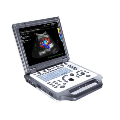 China Hard Disk 15 Color LCD Monitor Portable High Resolution Acrylic Adjustable Color Doppler 1T Doppler Ultrasound System for sale