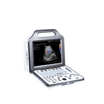 China Acrylic Human Use Portable Color Doppler Ultrasound Diagnostic System for sale