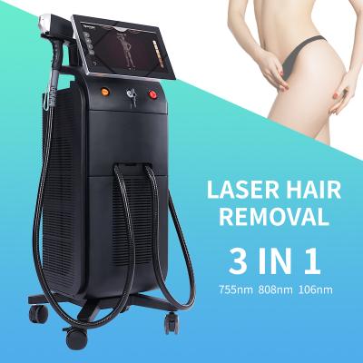 China Other OEM Soprano Ice Epilator Alexandrite 808nm Diode Laser 755 Permanent Hair Remover Laser Hair Removal Beauty Machine 808 1064 for sale