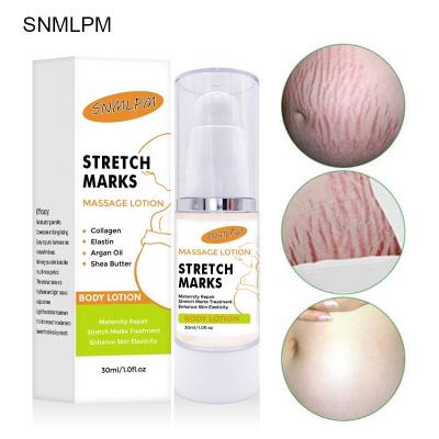 China Skin Revitalizer 2021 Professional Supplier Private Label Lotion Form Pregnancy Marks Remover Stretch Mark Removal Cream for sale