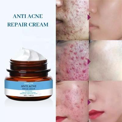 China Moisturizer Top Selling Herbal Moisturizer Nourishing Brightening Removal Pimples Scar Anti Acne Cream for sale