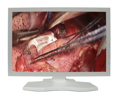 China Full HD Metal LCD Medical Endoscope Monitor for ENT, Laparoscopy, Arthroscopy 24 inch for sale