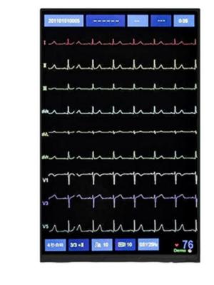 China 31-Pin-MIPI-Schnittstelle 10,1 Zoll Touchscreen-Display TFT-Display-Modul 800*1280 zu verkaufen