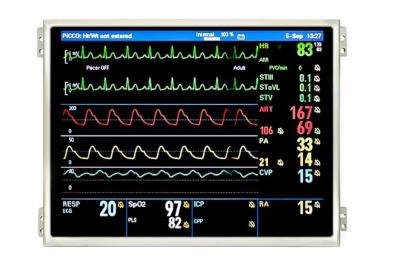 China Langlebige 10,1 Zoll TFT-LCD-Modul für Patientenmonitor mit Auflösung 1024*768 zu verkaufen