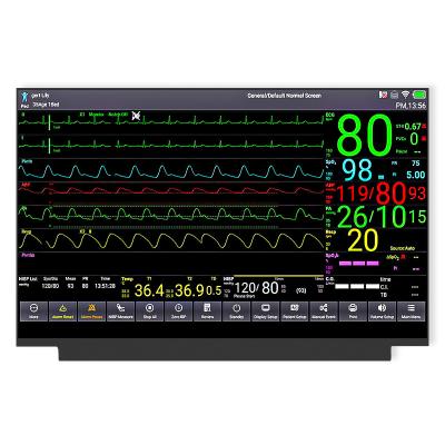 Cina Interfaccia EDP a 30 pin con display LCD da 15,6' Moduli LCD TFT per monitor portatili in vendita