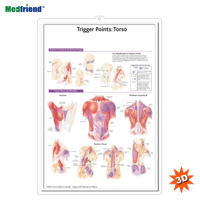 China PVC Material Licensed Educational Plastic Medical Anatomical Chart /Poster - Trigger Wall 3D Points: Torso for sale