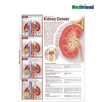 China PVC Material Authorized Educational Plastic Medical Anatomical Chart /Poster - Kidney Wall 3D Cancer for sale