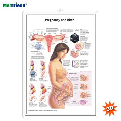 China PVC Material Licensed Educational Plastic Medical Anatomical Chart /3D Wall Poster - Pregnancy and Birth for sale