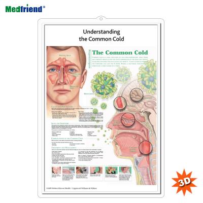 China PVC Material Authorized Educational Plastic Medical Anatomical Chart /Poster - 3D Wall Understanding The Common Cold for sale