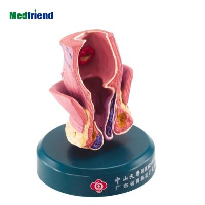 China Patients Care Advanced Anatomical Demonstration Model Maker-- Colon-Anus and Colon Model for sale