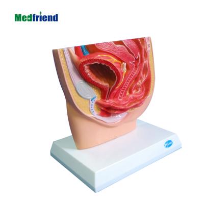 China Patients Care Demonstration Factory Price Anatomical Human Male Pelvis Anatomical Model for sale