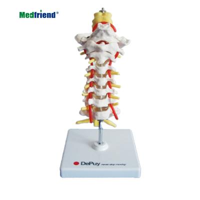 China Patients Care Demonstration Factory Price Melleco Advanced Cervical Vertebra Artery Spine , Spinal Nerves Anatomical Model for sale