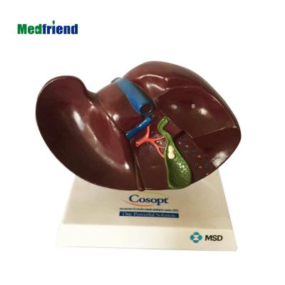 China Patients care anatomical demonstration the liver gallbladder model with gallstones for sale