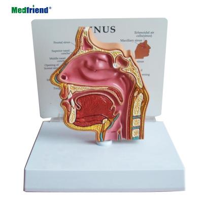 China Patients Care Demonstration Factory Price Anatomical Basic Sinus Model With Education Card for sale