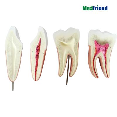 China Patients care anatomical oversized demonstration molar and premolar model for sale