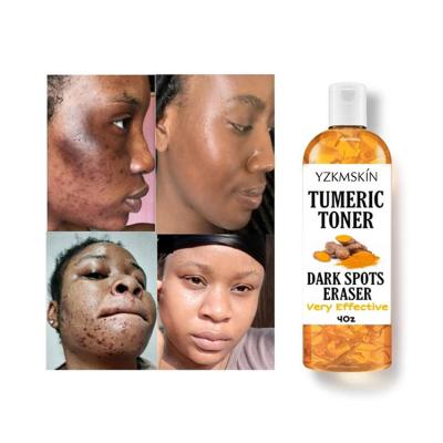 China Toner Private Label Organic Fades Blemishes Turmeric Facial Toner Strong Lightening Dark Spot Tumeric Toner for sale