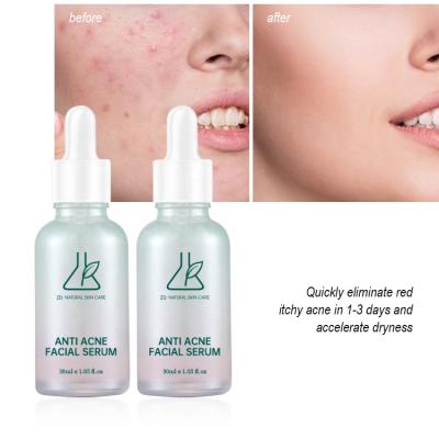 China Manufacturer Private Label Face Serum Custom Anti Acne Black Head Anti Inflammatory Moisturizing Facial Remover Serum for sale