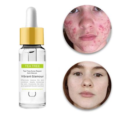 China Korean Natural Organic Herbal Herbal Remover Acne Treatment Repair Acne Face Night Serum Korean Natural Anti Acne Pimple Anti Aging Tea Tree Private Label Face Serum for sale