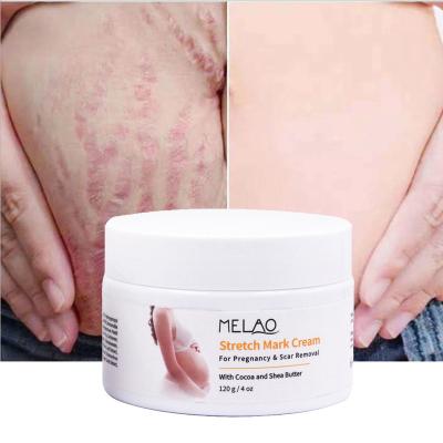 China OEM/ODM Natural Vegan Private Label Anti Postpartum Brightening Acne Scar Removal Deep Stretch Mark Cream for sale