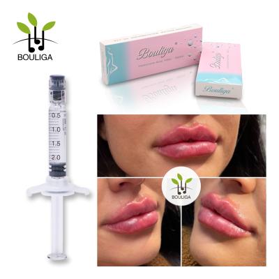 China Linha cutânea ácida hialurónica injetável cruz do gel 2ml Derm do enchimento de Bouliga ligada para os bordos à venda