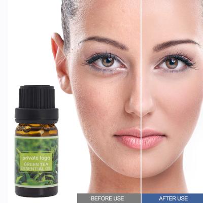 China Skin Rejuvenation Good Selling Private Label Factory Green Tea Tree Skin Care Essential Oil for sale