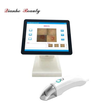 China Hot Selling Portable Skin Wrinkle Analysis Machine Observation Magic Skin Analyzer With Factory Price for sale