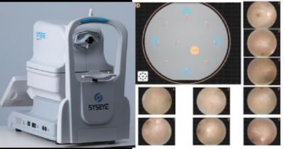 China Professional Non Mydriatic Fundus Camera For Accurate Imaging for sale