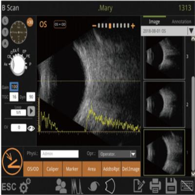 China Mini Ultrasound Scanner Machine With Intelligent Digital Software Multiple IOL Calculation Formulas for sale