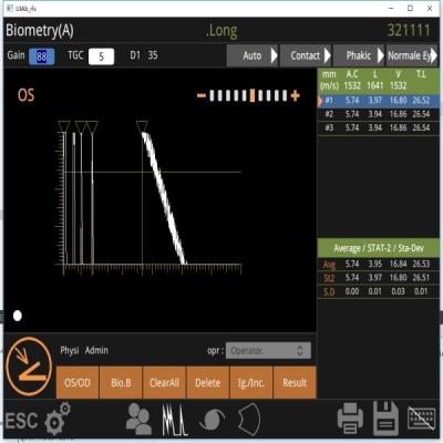 China Scan-Maschine 10MHz des Fan-Scan-B, Netzhauttrennung beobachtend zu verkaufen