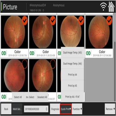 Cina Tomografia manuale di coerenza di oftalmologia della macchina fotografica del fondo di Digital in vendita