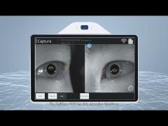 FDA Automated Fundus Camera Retinal Digital Eye Fundus Camera