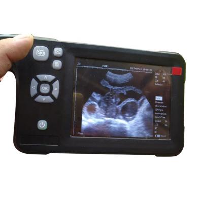 중국 Four-Color Portable Cattle Ultrasound Scanner Livestock Pregnancy Testing Machine Ultrasound Scanner PIG B Detector Portable Pseudocolor 판매용