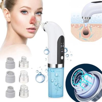 China Acne Treatment Face Beauty Microcurrent Vacuum Blackheads Whiteheads Remover Instrument For Exfoliation for sale