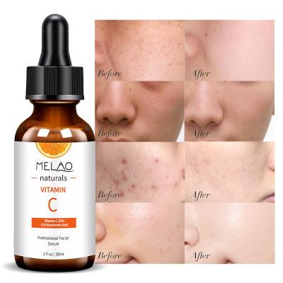 China Moisturizer Nature Serum Vitamin C Whitening Best Vitamin C Serum For Face Care for sale