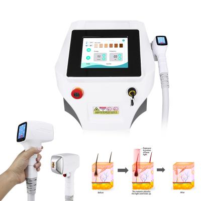 China Diode Laser Hair Removal Machine Soprano Titanium 808nm 755nm 1064nm for sale