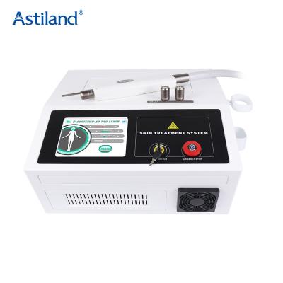 China Tattoo Pigment Removal Machine ND YAG Laser Tattoo Removal Machine for sale