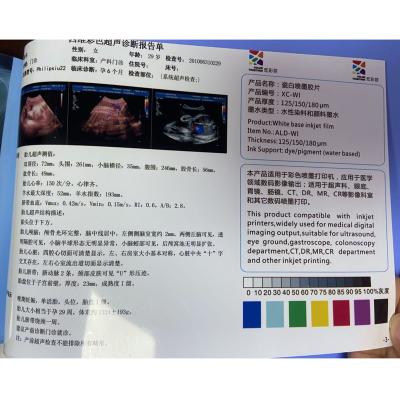 China Medical Print Like Ultrasound Inkjet Printing X Ray Medical Dry Laser X-Ray Imaging Film For Medial Devices for sale