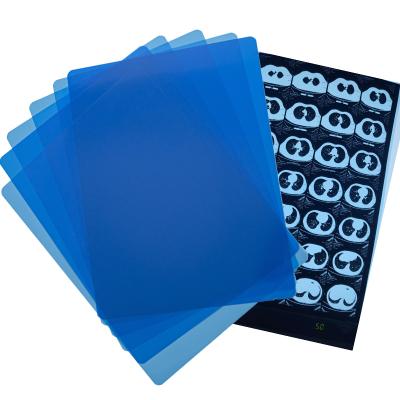 China Antibacterial Blue Inkjet Medical X Ray Film Medical Dry Film A4 Sheet Or In Roll for sale